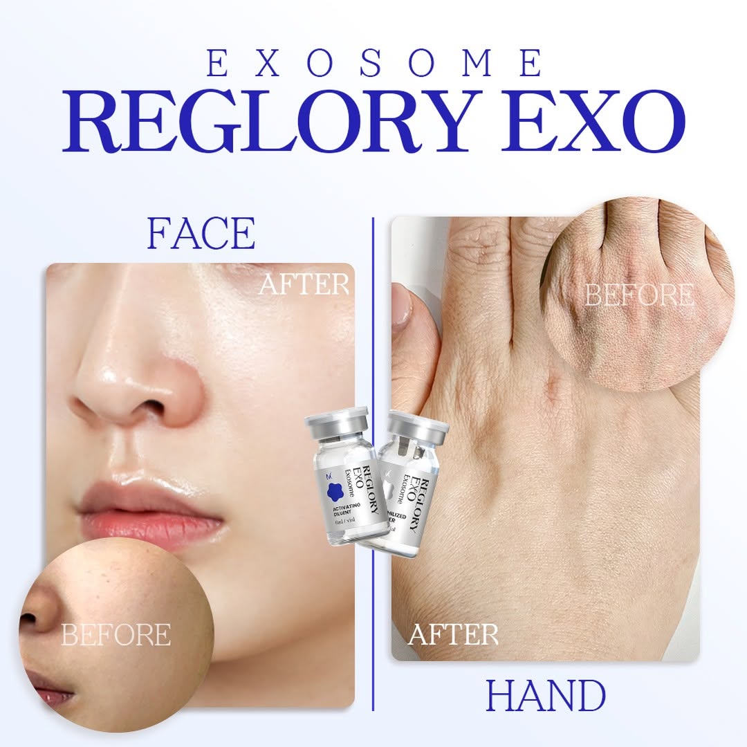 Reglory EXO_1