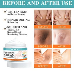 whitening cream for Private part and sensitive areas underarm 7 days result cream.