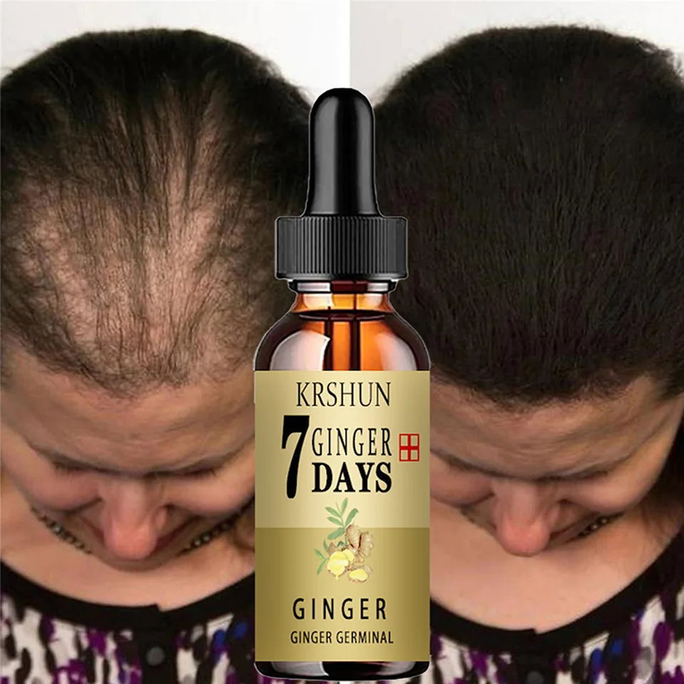 Hair Growth Oil_2