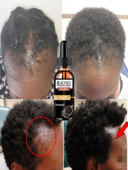 Hair Growth Oil