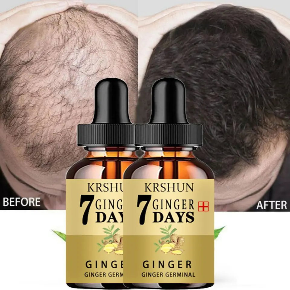 Hair Growth Oil