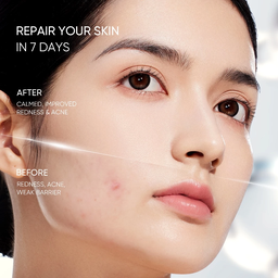 Skintific Sensitive Moisture Gel 30g