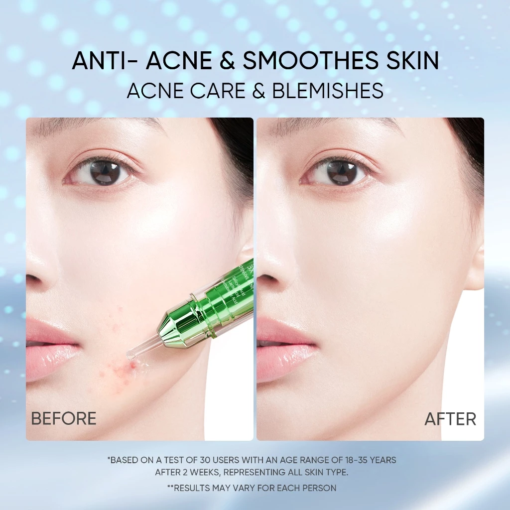 Skintific 3x Acid Intensive Acne Spot Gel 15ml_7
