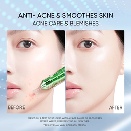 Skintific 3x Acid Intensive Acne Spot Gel 15ml