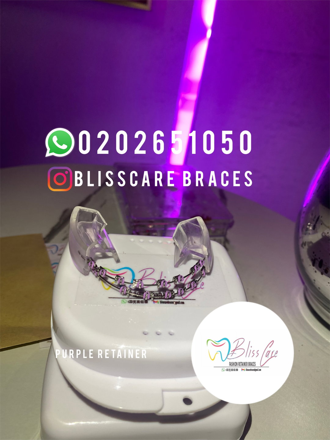 Purple Removable Braces