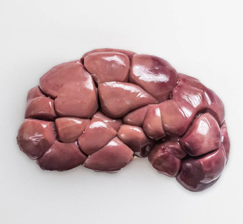 Kidney _0