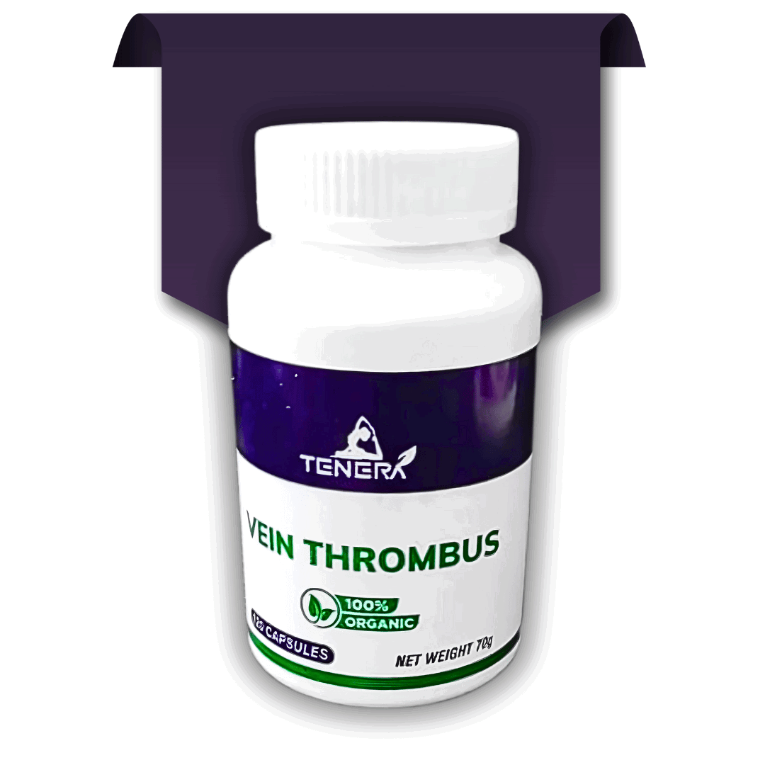 Vein thrombus_0