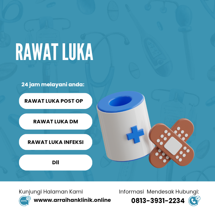 RAWAT LUKA MODERN