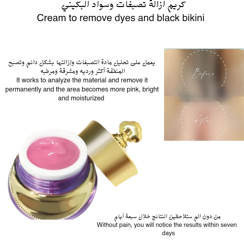 مجموعة توريد المناطق الحساسه والمفاصل🍒💕_6