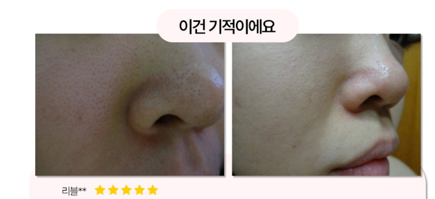 (Hot Hot Sale!) Mega Sale Legendary Magic Pore Pack_7