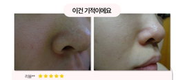 (Hot Hot Sale!) Mega Sale Legendary Magic Pore Pack