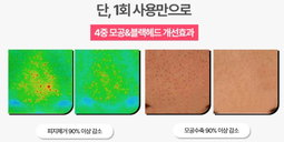 (Hot Hot Sale!) Mega Sale Legendary Magic Pore Pack