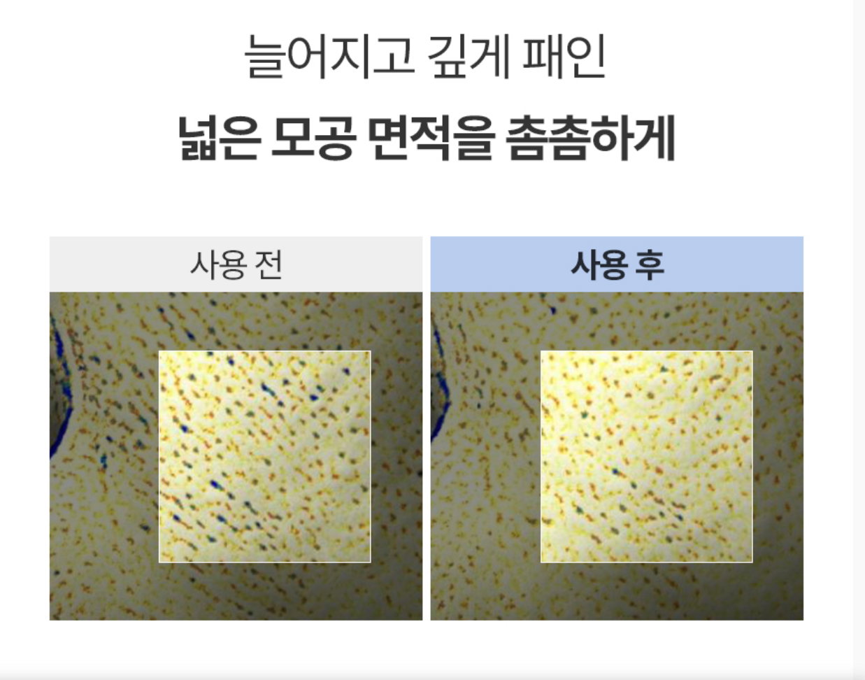 [모공,주름] 보툴케어 모공 마스크 42g [4매입] | [Pore& Wrinkle Care] Pore Care Mask_4