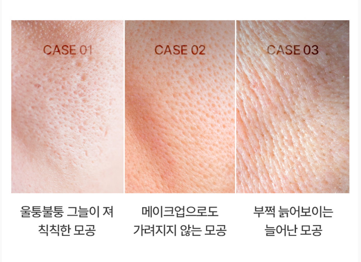 [모공,주름] 보툴케어 모공 마스크 42g [4매입] | [Pore& Wrinkle Care] Pore Care Mask_3