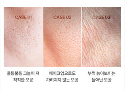 [모공,주름] 보툴케어 모공 마스크 42g [4매입] | [Pore& Wrinkle Care] Pore Care Mask