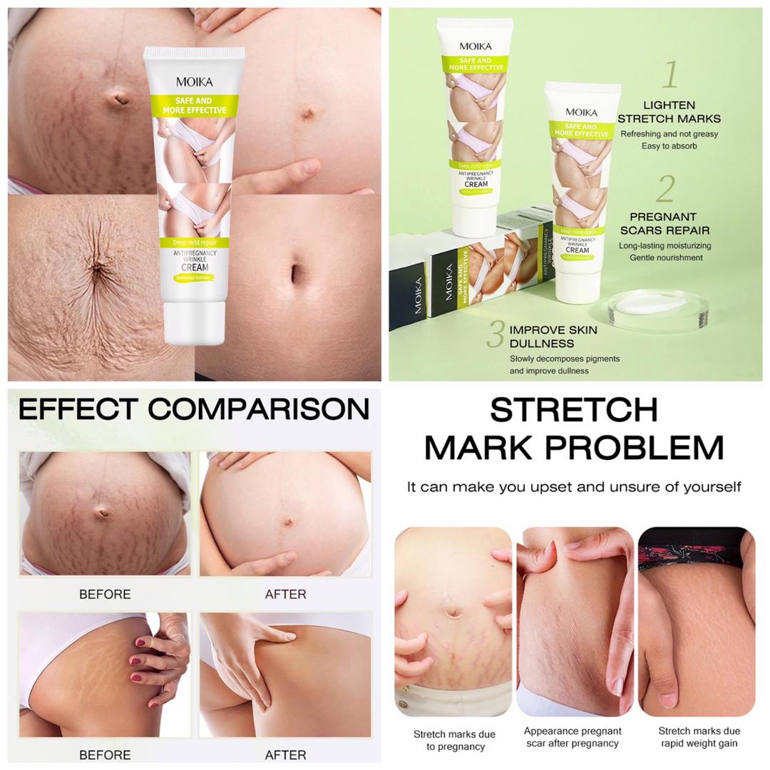 MOIKA STRETCH MARK CREAM 