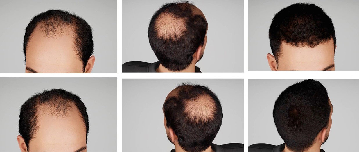 Hair / Beard Growth Oil_2