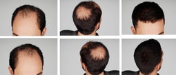 Hair / Beard Growth Oil