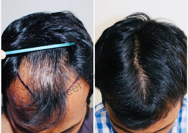 Hair / Beard Growth Oil_3