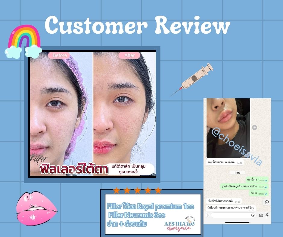 Review 🩷💉_0