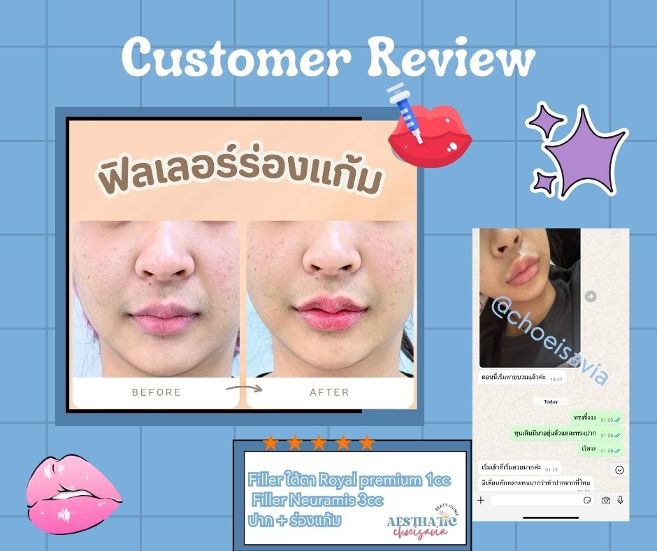 Review 🩷💉_1