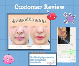Review 🩷💉