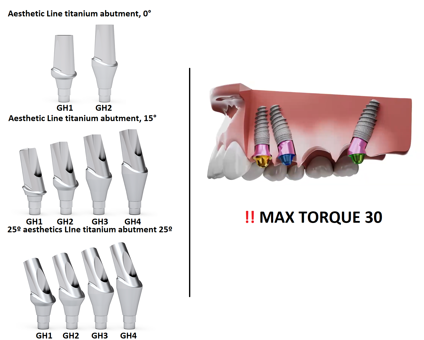 ICX Premium Bone Level IMPLANT Ø4.8_4