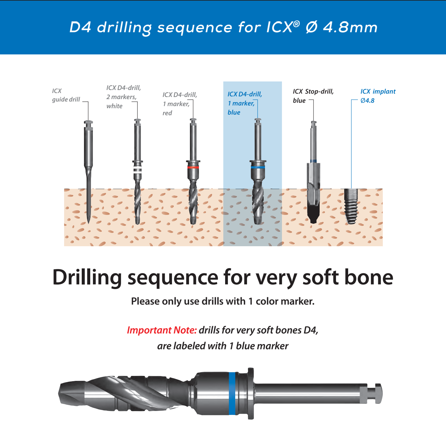 ICX Premium Bone Level IMPLANT Ø4.8_7