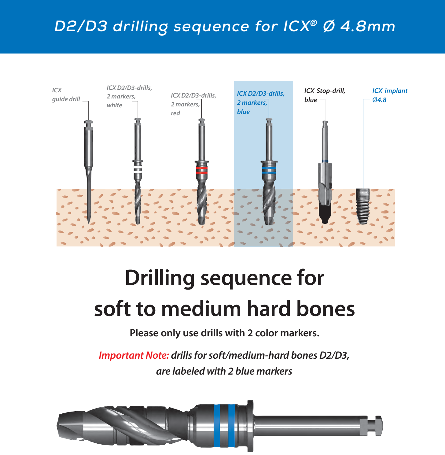 ICX Premium Bone Level IMPLANT Ø4.8_8