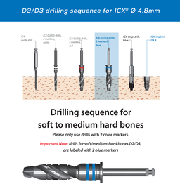 ICX Premium Bone Level IMPLANT Ø4.8