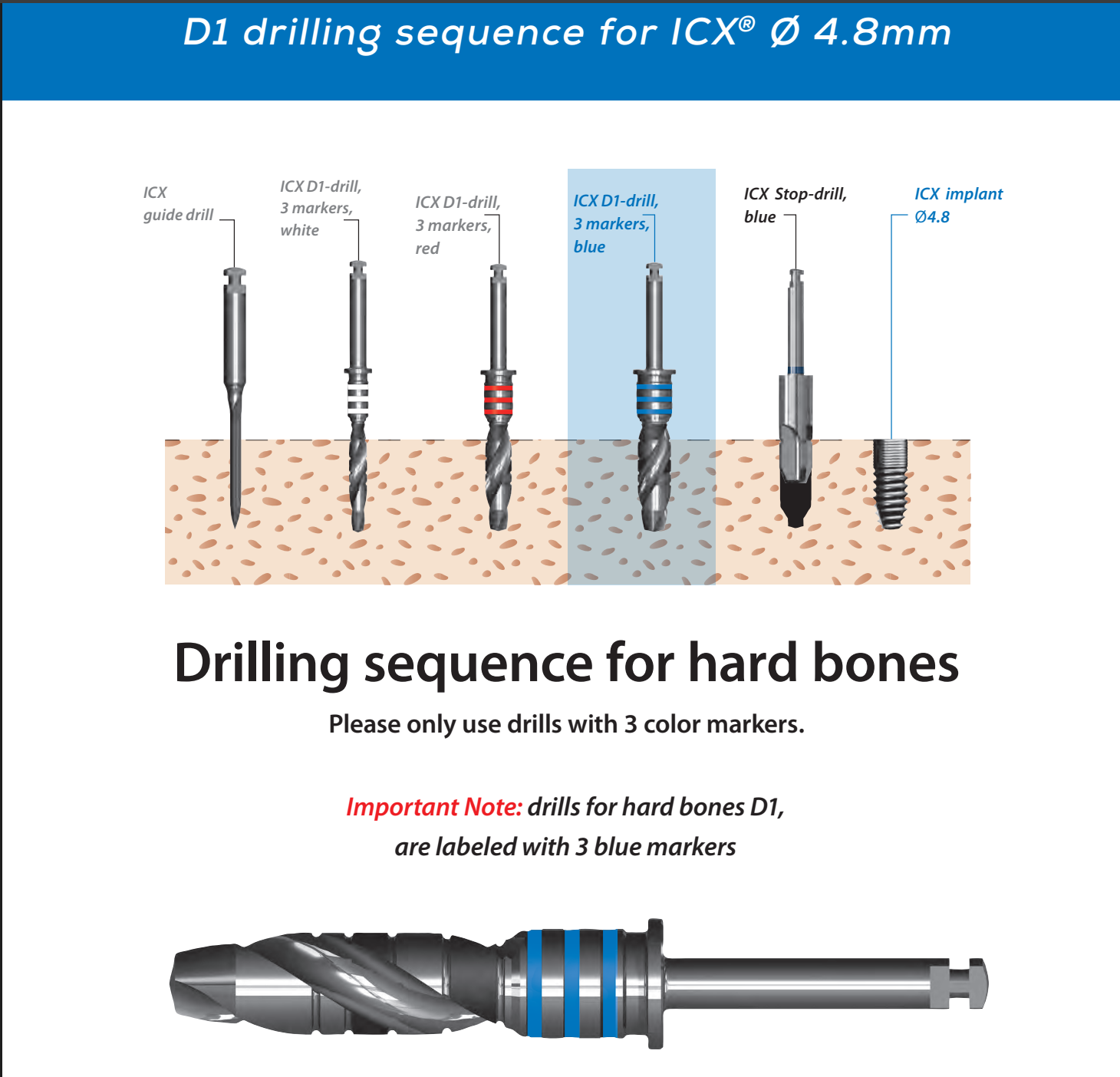 ICX Premium Bone Level IMPLANT Ø4.8_9