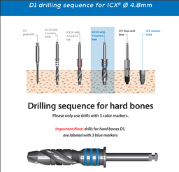 ICX Premium Bone Level IMPLANT Ø4.8
