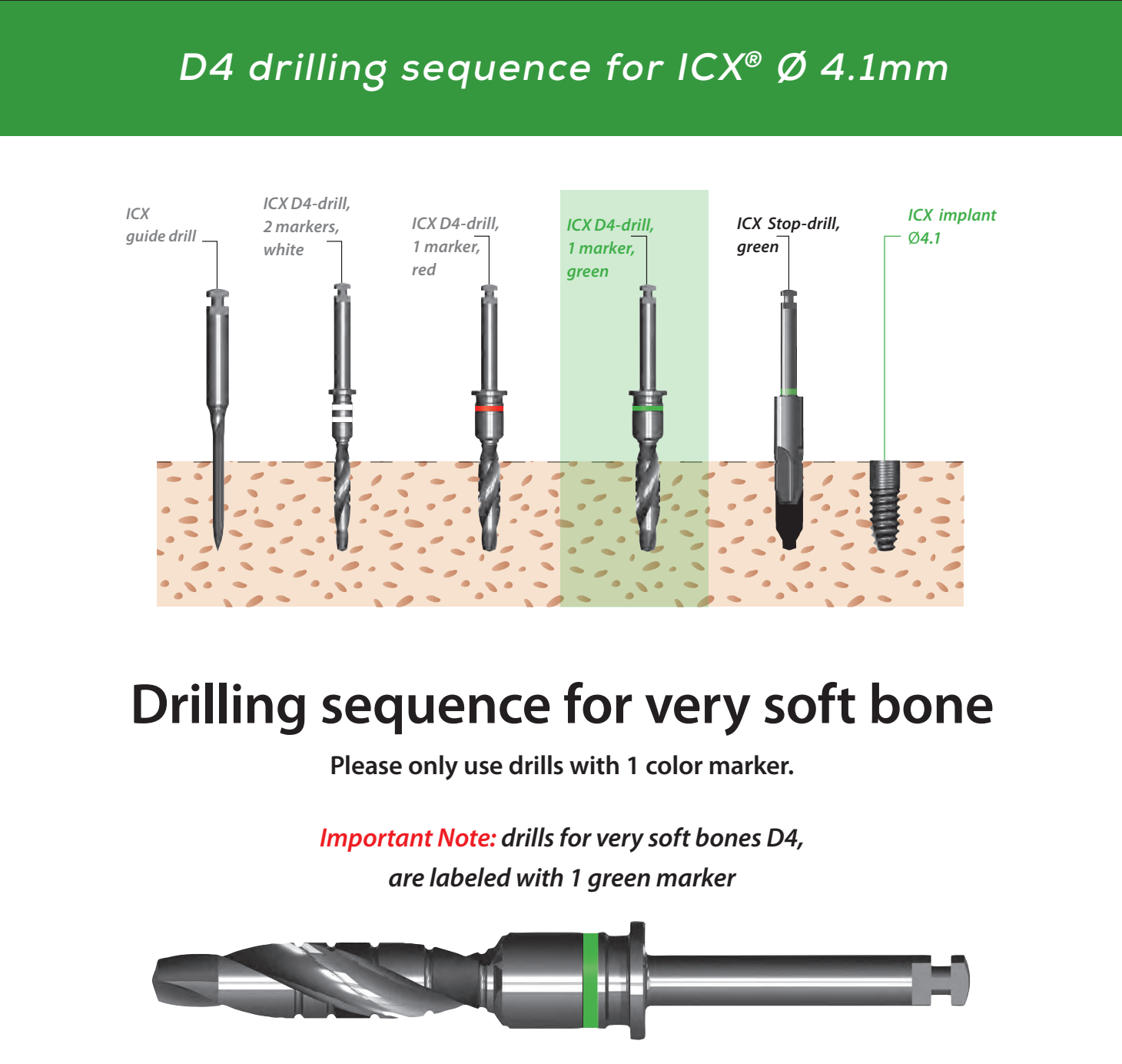 ICX Premium Bone Level IMPLANT Ø4.1_7