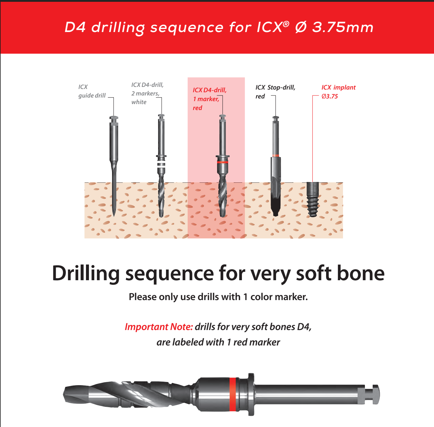ICX Premium Bone Level IMPLANT Ø3.75_7