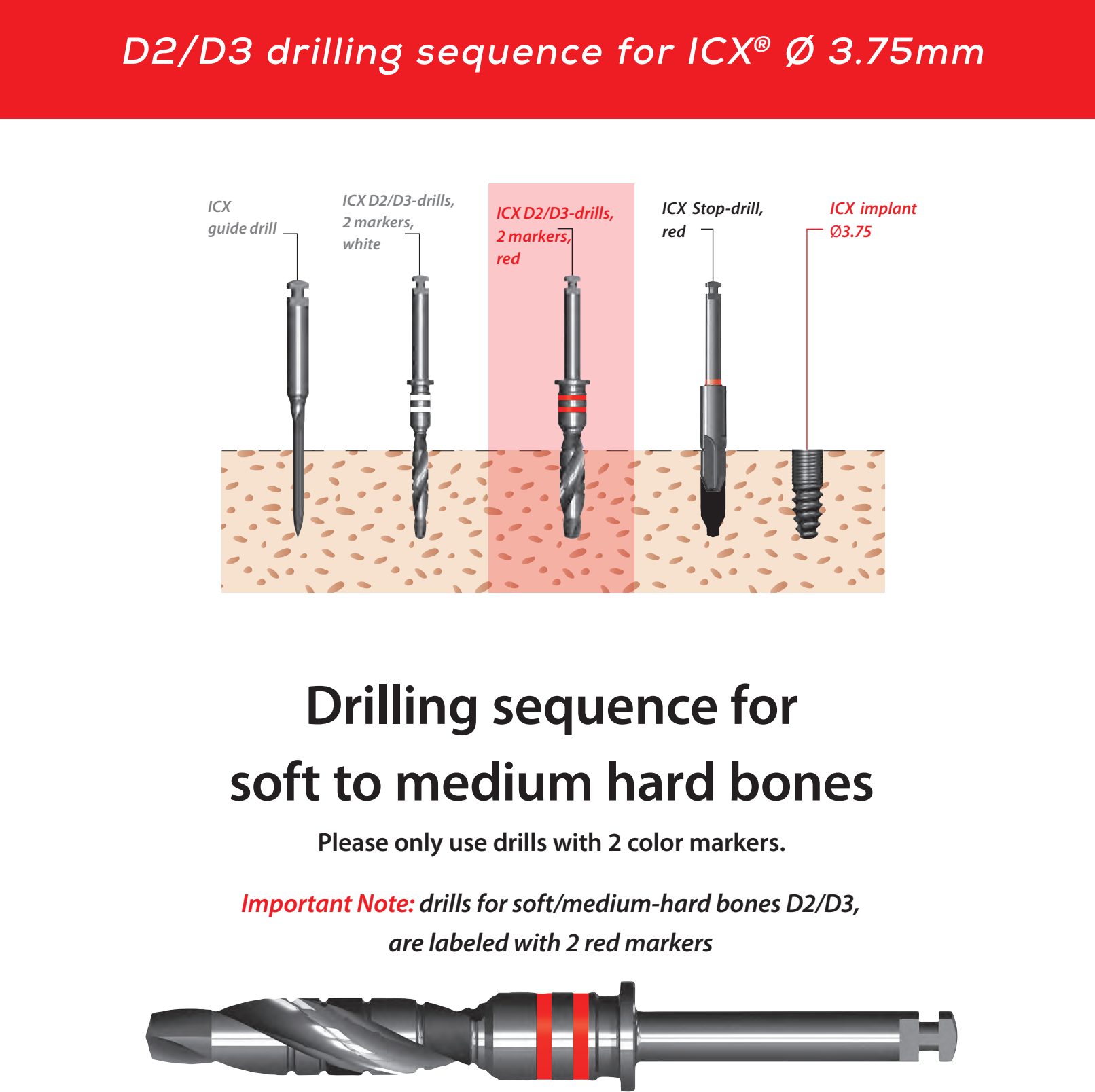 ICX Premium Bone Level IMPLANT Ø3.75_8