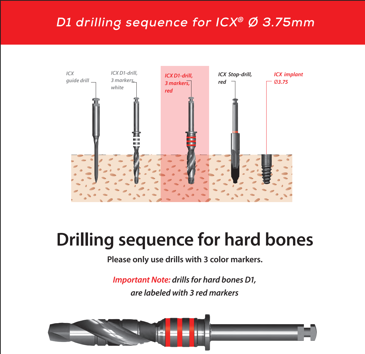 ICX Premium Bone Level IMPLANT Ø3.75_9
