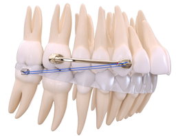POWER BAR CLASS II CORRECTOR 