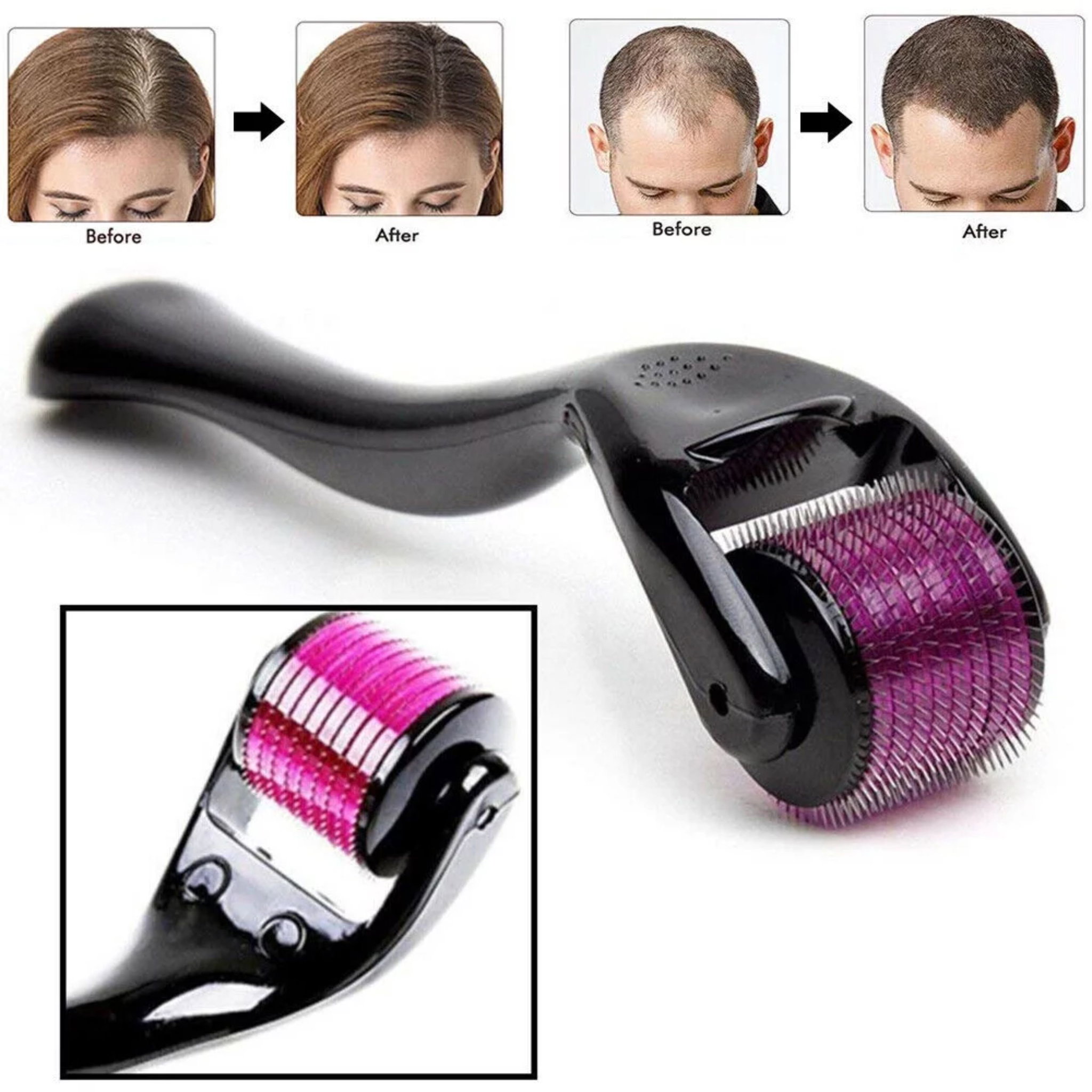 ديرما رولر DERMA ROLLER SYSTEM	_1