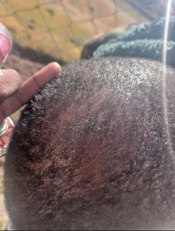 Botlē Hair Growth combo by SEFATE SA BOPHELO (Maseru cosmetics)