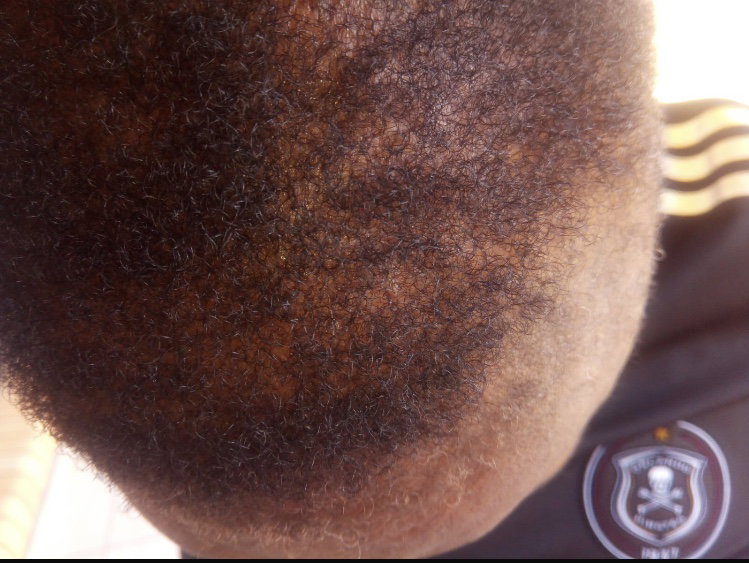 Botlē Hair Growth combo by SEFATE SA BOPHELO (Maseru cosmetics)_3