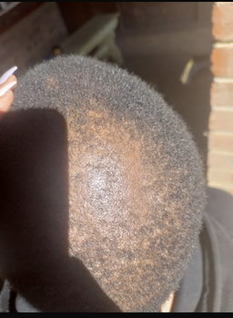 Botlē Hair Growth combo by SEFATE SA BOPHELO (Maseru cosmetics)