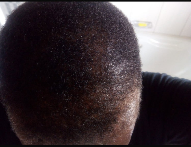 Botlē Hair Growth combo by SEFATE SA BOPHELO (Maseru cosmetics)_4