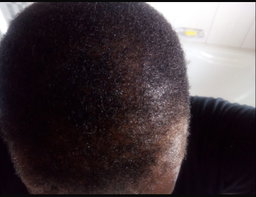 Botlē Hair Growth combo by SEFATE SA BOPHELO (Maseru cosmetics)