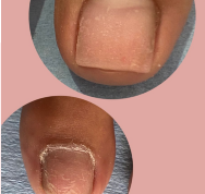 Pedicure en Seco o Preventivo_0