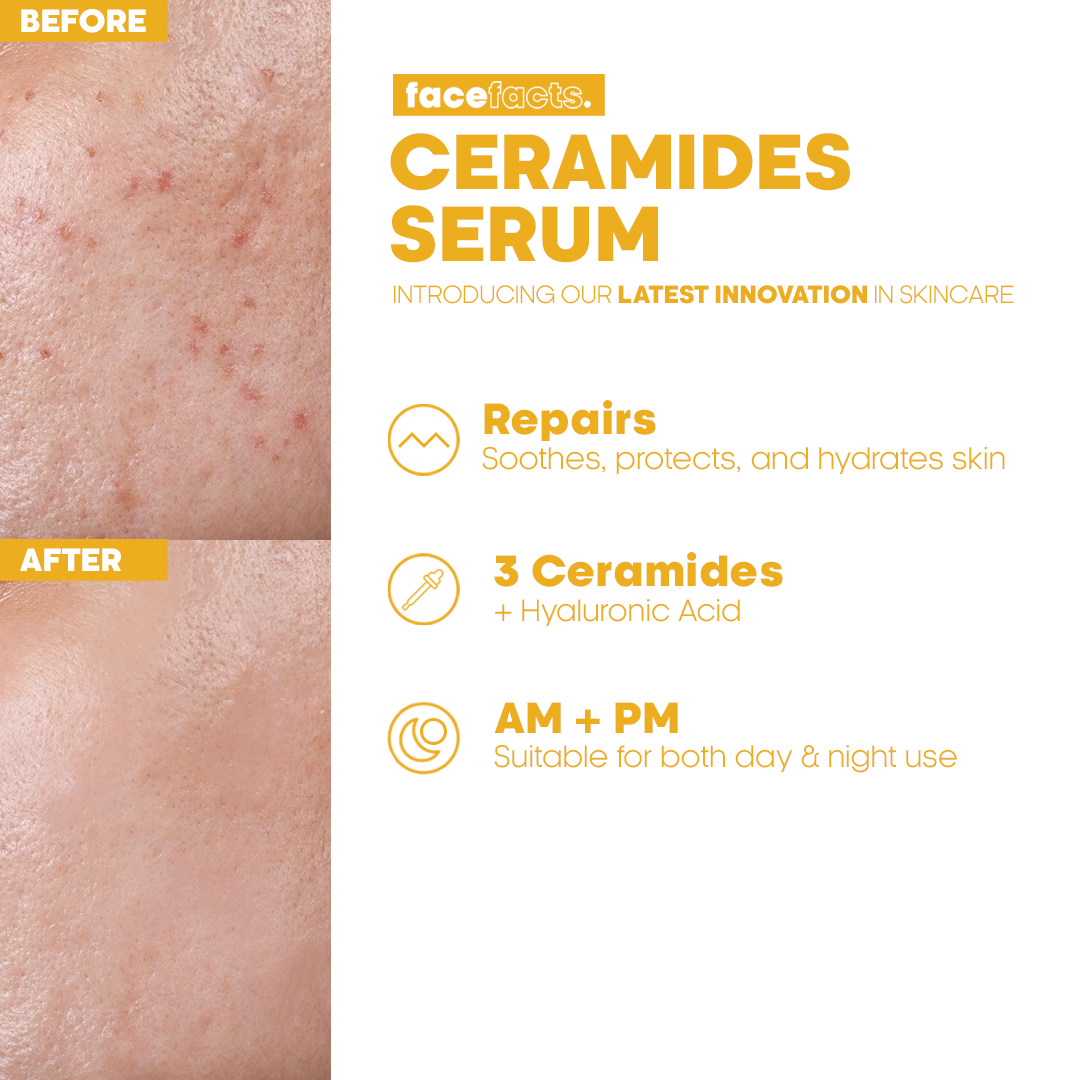 Face Facts Barrier Repair Ceramide Facial Serum_1