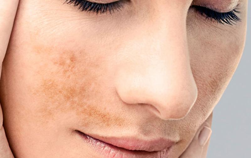 Base Crema Corporal Desvanecedora de manchas _1