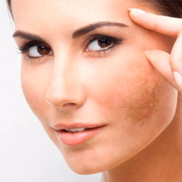 Base Crema Corporal Desvanecedora de manchas 