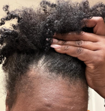 8 oz Rosemary AVC Rinse_1