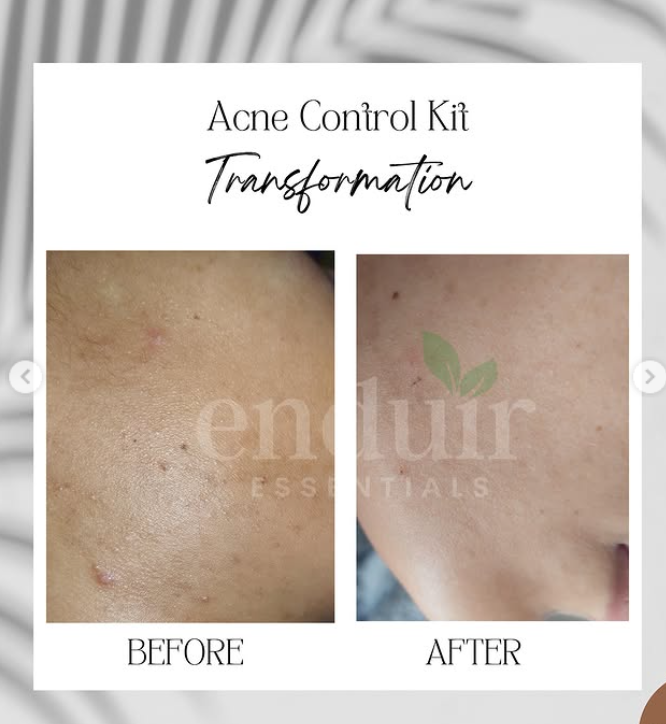 Acne Control Face Wash (Aloe & Moringa)_1