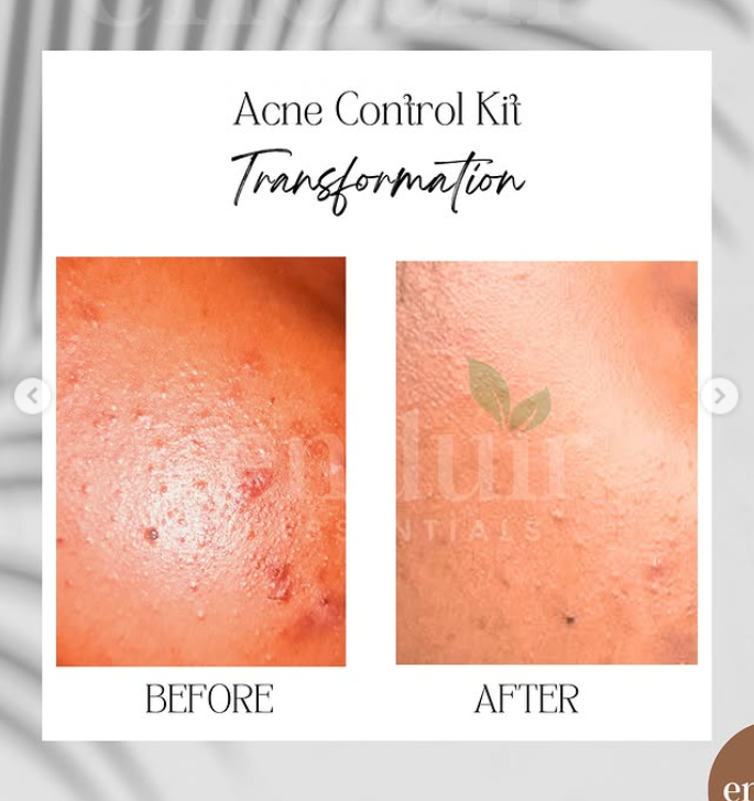 Acne Control Face Wash (Aloe & Moringa)_2